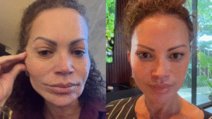 Solange Almeida revela resultado de lifting facial e surpreende fãs