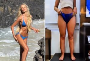 Yasmin Brunet revela perda de 25 kg após tratamento de lipedema