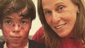 Morre neto de Deborah Colker que tinha mutação genética