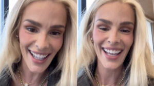 Yasmin Brunet revela perda de 25 kg após tratamento e mostra antes e depois; VEJA